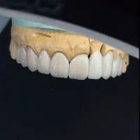 تخفیف ویژه ویژه ویژه روکش|خدمات آرایشگری و زیبایی|تهران, جوادیه|دیوار