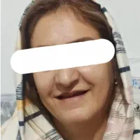 دندان مصنوعی - دندانسازی -تخفیف ویژه و تعرفه دولتی|خدمات آرایشگری و زیبایی|مشهد, فاطمیه|دیوار