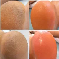 اسپا ویژه بانوان و اقایان همراه با ماساژ کف پا
