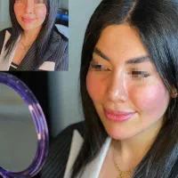 تزریق ژل چربی بوتاکس جوان ساز مزو پی آرپی|خدمات آرایشگری و زیبایی|رشت, گلسار|دیوار