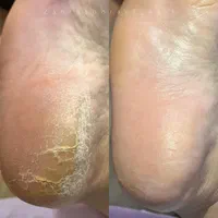 تخفیف ویژه ۵۰٪روی خدمات ناخن و آموزش‌|خدمات آرایشگری و زیبایی|اصفهان, ملک‌شهر|دیوار