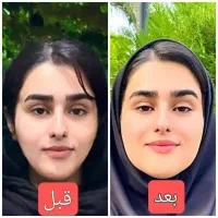 خیلی راحت بدون رژیم سخت چربیسوزی کن|آرایشی، بهداشتی، درمانی|سبزوار, دانشگاه آزاد|دیوار