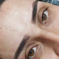 فیبروز ابرو