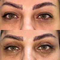 عمل پلک لیفت ابرو سانترال لب تخفیف ویژه