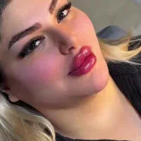 تخفیف 50% فیلر و بوتاکس250فقط فردا مادلینگ1300