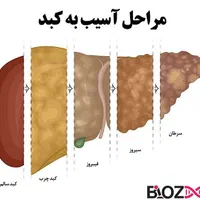 کبدت چربه اگه این علائم رو داری