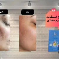 اکسیرجوانی|آرایشی، بهداشتی، درمانی|تالش, هشتپر|دیوار