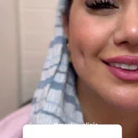 چال گونه تخصصی