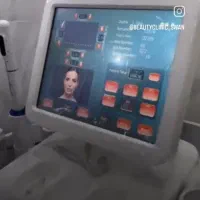 دستگاه هایفو کره ای