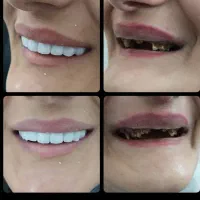 کلیه خدمات دندان پزشکی