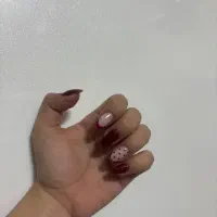 ترمیم ناخن