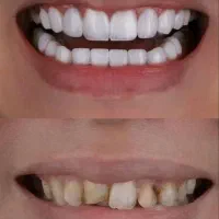 کلینیک دندانپزشکی پرلین زیبایی و درمانی