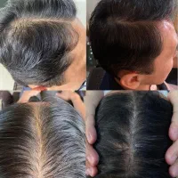 کچلی خداحافظ