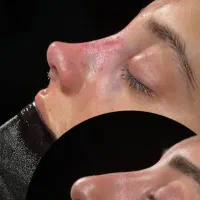 عمل و جراحی بینی 23تا25 میلیون /مشاوره رایگان|خدمات آرایشگری و زیبایی|کرج, عظیمیه|دیوار