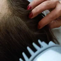 آموزش اسکراب اسکالپ سردرمشهد با مدرک رسمی