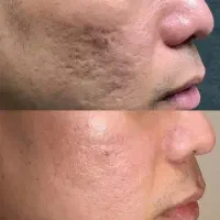 ژل و بوتاکس کاشت ابرو قسطی|خدمات آرایشگری و زیبایی|یاسوج, |دیوار