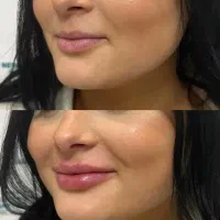 کلینیک تخصصی اریکا (لیزر و پوست و‌ مو )