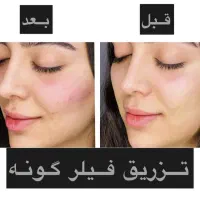 تزریق وآموزش فیلر و بوتاکس|خدمات آموزشی|فردیس, فردیس|دیوار