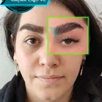 تزریق چربی تخلیه غبغب جراحی بلفاروپلاستی حفره بینی|خدمات آرایشگری و زیبایی|کرج, باغستان|دیوار