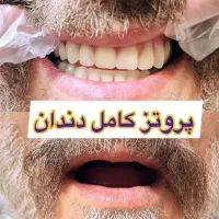 دندانسازی دلین...کشیدن با قیمت مناسب