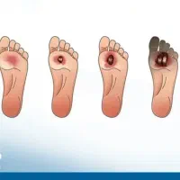 درمان با طب سنتی|خدمات آرایشگری و زیبایی|یاسوج, |دیوار