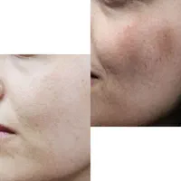 کرم ضدلک مون لایت الماس شیده ضد لک روشن کننده|آرایشی، بهداشتی، درمانی|شیراز, احمدی جنوبی|دیوار