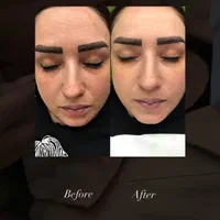 مدل برای پاکسازی پوست|استخدام درمانی، زیبایی، بهداشتی|تبریز, |دیوار