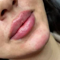 کلینیک زیبایی فارابی ارائه تمامی خدمات پوست و مو|خدمات آرایشگری و زیبایی|محمدیه-قزوین, |دیوار