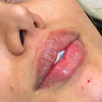 جشنواره ژل و بوتاکس و فیلر بادی و لیفت صورت|خدمات آرایشگری و زیبایی|تهران, صادقیه|دیوار