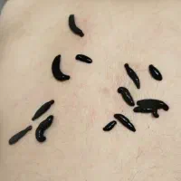 حجامت زالو فصد بادکش دیسک سیاتیک دررفتگی زردی ناف|خدمات آرایشگری و زیبایی|گنبد کاووس, |دیوار