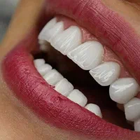 مرکز تخصصی کامپوزیت در شیراز مطب دندانپزشکی|خدمات آرایشگری و زیبایی|شیراز, ملاصدرا|دیوار