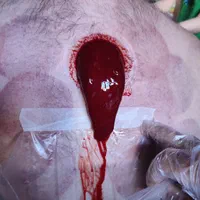 حجامت و فصد خون تخصصی با بیش از هفده سال سابقه|خدمات آرایشگری و زیبایی|سنندج, |دیوار