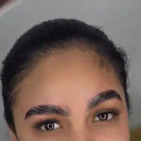 کاشت هیدن و لیفت ابرو