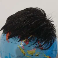 پروتز مو محکم و بادوام و سالم