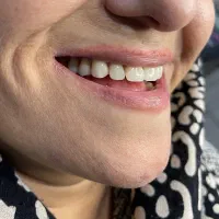 لابراتوار دندانسازی تخصصی