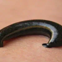 زالو طبی ارایشی