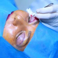 خدمات زیبایی و لیزر|خدمات آرایشگری و زیبایی|دهلران, |دیوار