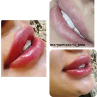 مدل میکروبلیدینگ فیبروز شیدینگ لب خط چشم ریموو|خدمات آرایشگری و زیبایی|تهران, سردارجنگل|دیوار