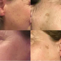 خال|خدمات آرایشگری و زیبایی|سرپل ذهاب, |دیوار