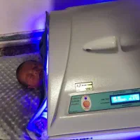 اجاره دستگاه LEED زردی نوزاد *تضمینی*همه مناطق|خدمات زیبایی و سلامت|تهران, یافتآباد|دیوار