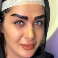 میکرو کاشت ابرو
