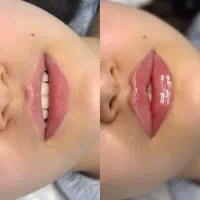 استخدام دستیار پزشک زیبایی روزهای زوج