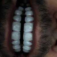 دندانپزشکی،لمینت،کامپوزیت،عصب کشی|خدمات آرایشگری و زیبایی|تهران, مشیریه|دیوار