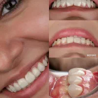 دندانپزشکی به صورت رایگان توسط متخصص عصب کشی ،ارتو