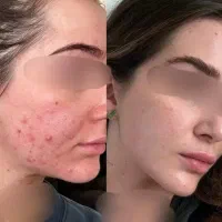 کرم بیوممتیک  ۱۰٪ تخفیف (هدیه ارسال رایگان )