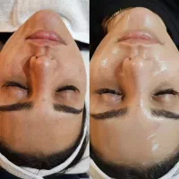 اموزش و خدمات فشیال،تتوصورت وتتوبدن