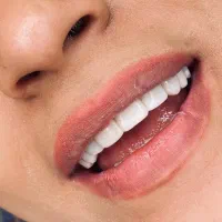 تخفیف ویژه کامپوزیت به مدت یک هفته|خدمات آرایشگری و زیبایی|اهواز, زیباشهر|دیوار