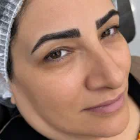 مدل میکروبلیدینگ