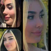 تخفیف عمل جراحی بینی لیفت لیپو ابدو کاشت ابرو مو|خدمات آرایشگری و زیبایی|کرج, عظیمیه|دیوار