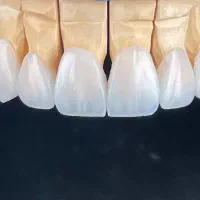 قابل توجه دندانپزشکان